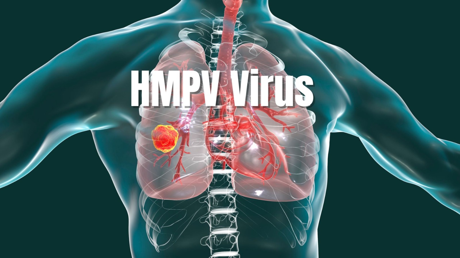 Rakyat Malaysia Perlu Berhati-Hati Dengan Penyakit Human Metapneumovirus (HMPV)